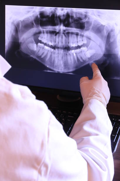 Best Broken or Chipped Tooth Repair in Beverly Hills, CA