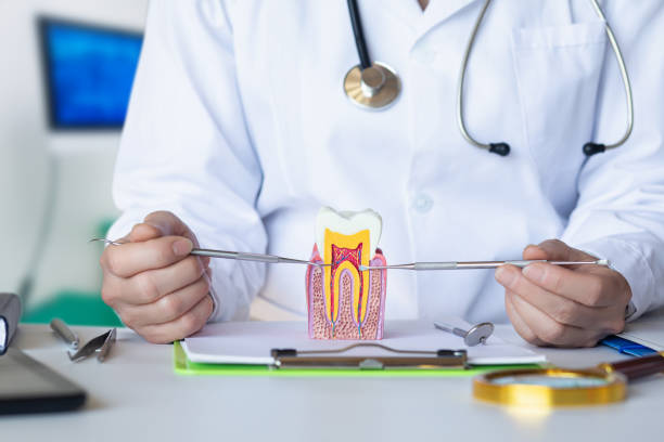 Best Knocked-Out Tooth (Avulsed Tooth) Treatment in Beverly Hills, CA