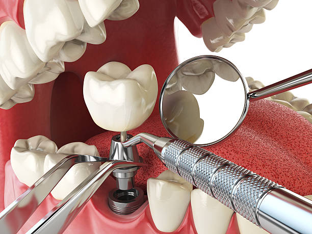 Best Emergency Treatment for Jaw Pain or Injury in Beverly Hills, CA